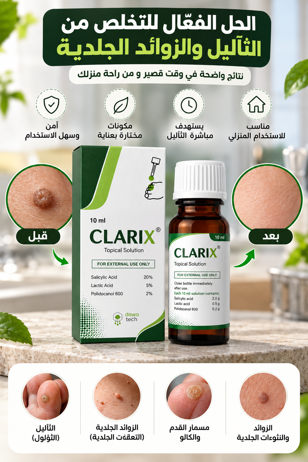 Clarix محلول طبي للتخلص من الثآليل والزوائد الجلدية ومسمار الرجل - قبل وبعد